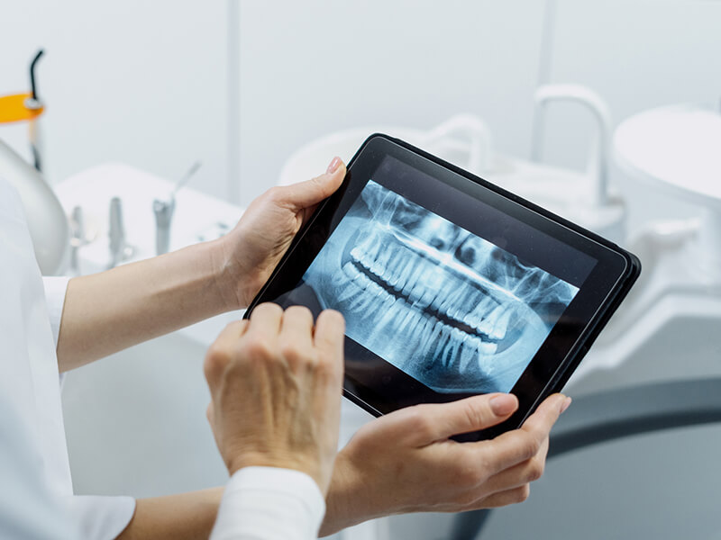 Person holding a black tablet displaying a dental X-ray image in a clinical setting.